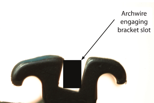 Orthodontic Brackets Orthodontic Brackets